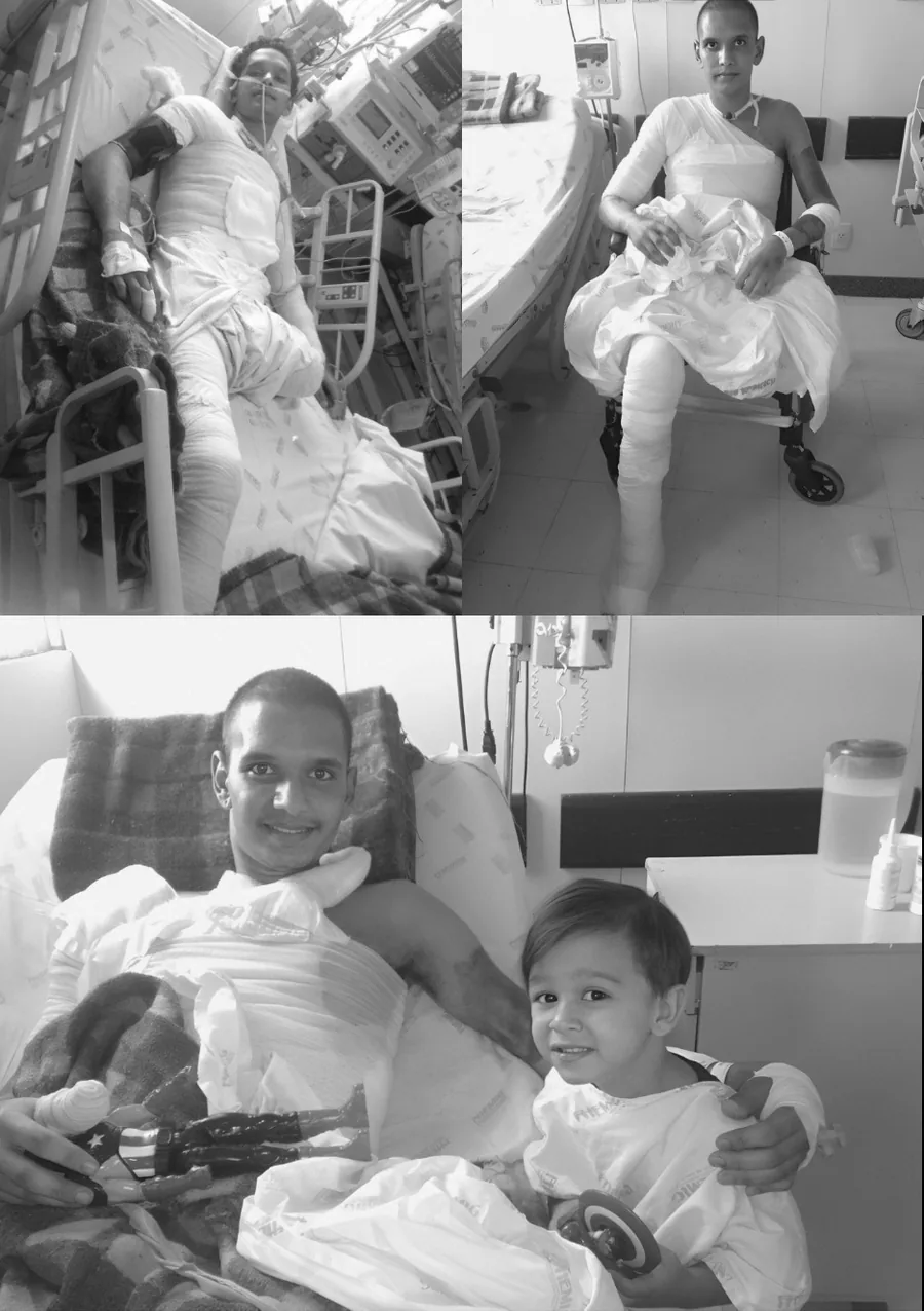 Deivson Lest em recuperação, ao lado do filho Pedro.